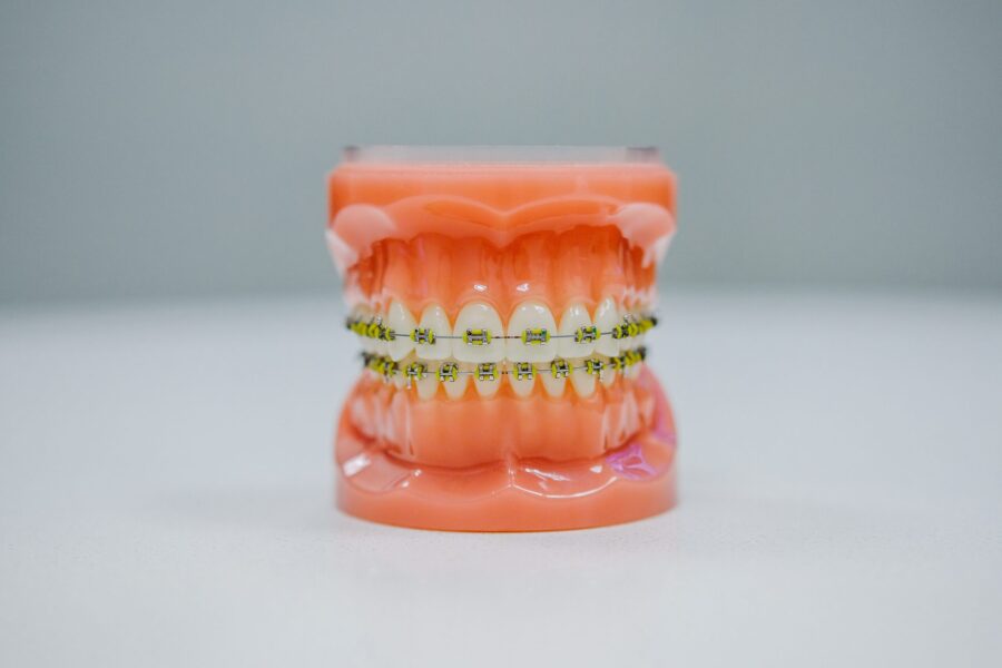 dental-braces-model